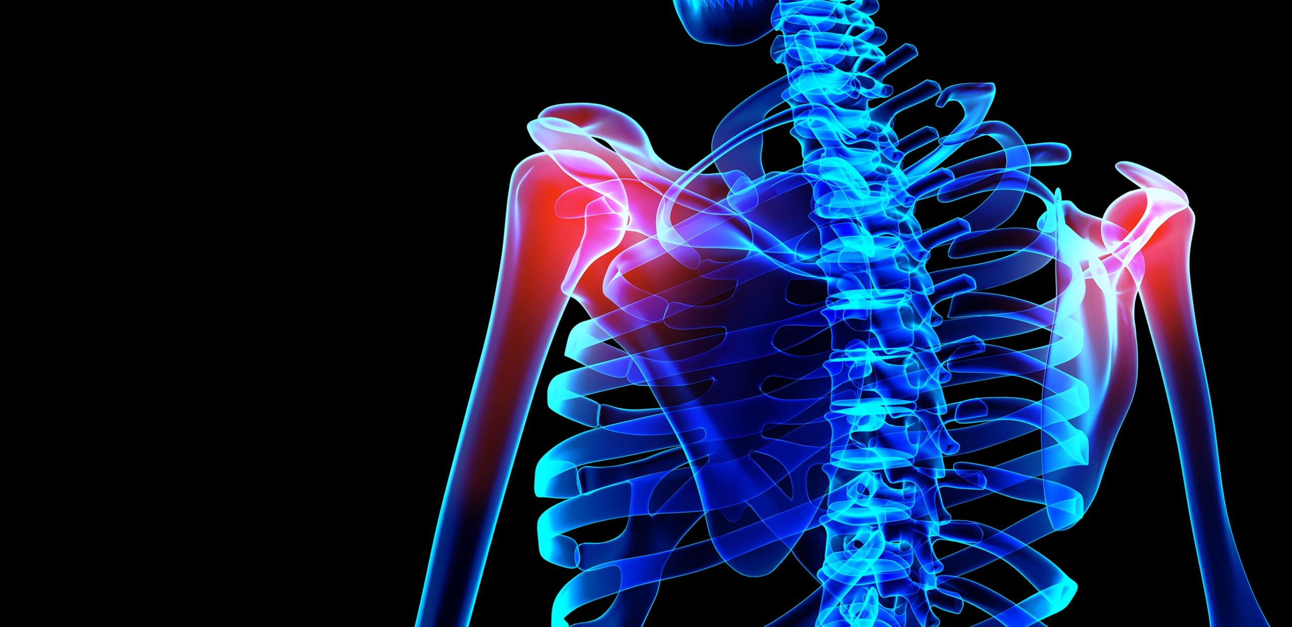 Spine Care Cooley Dickinson Orthopedics And Sport Medicine